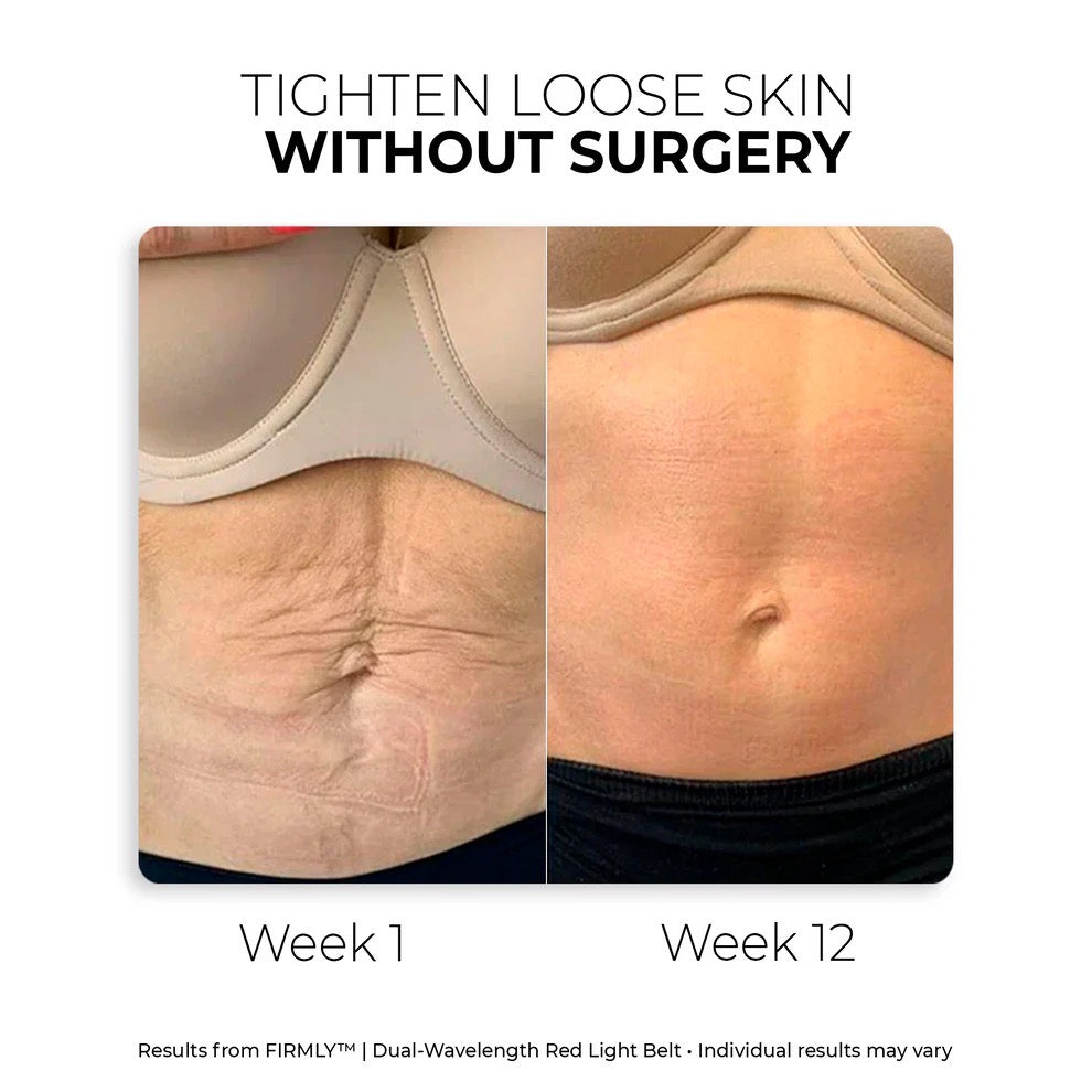 FIRMLY™ | Dual-Wavelength Red Light Belt with 3-Layer Lift Technology™