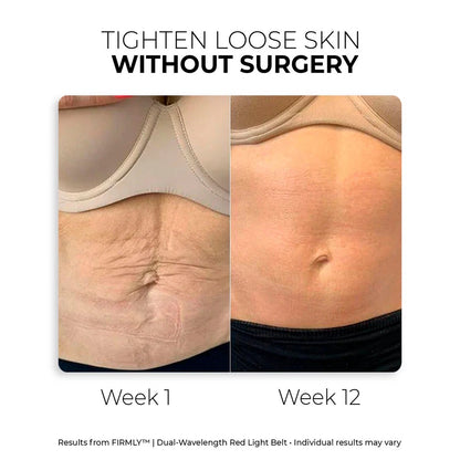 FIRMLY™ | Dual-Wavelength Red Light Belt with 3-Layer Lift Technology™